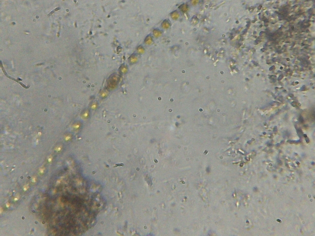 Puzza indicibile...batteri?